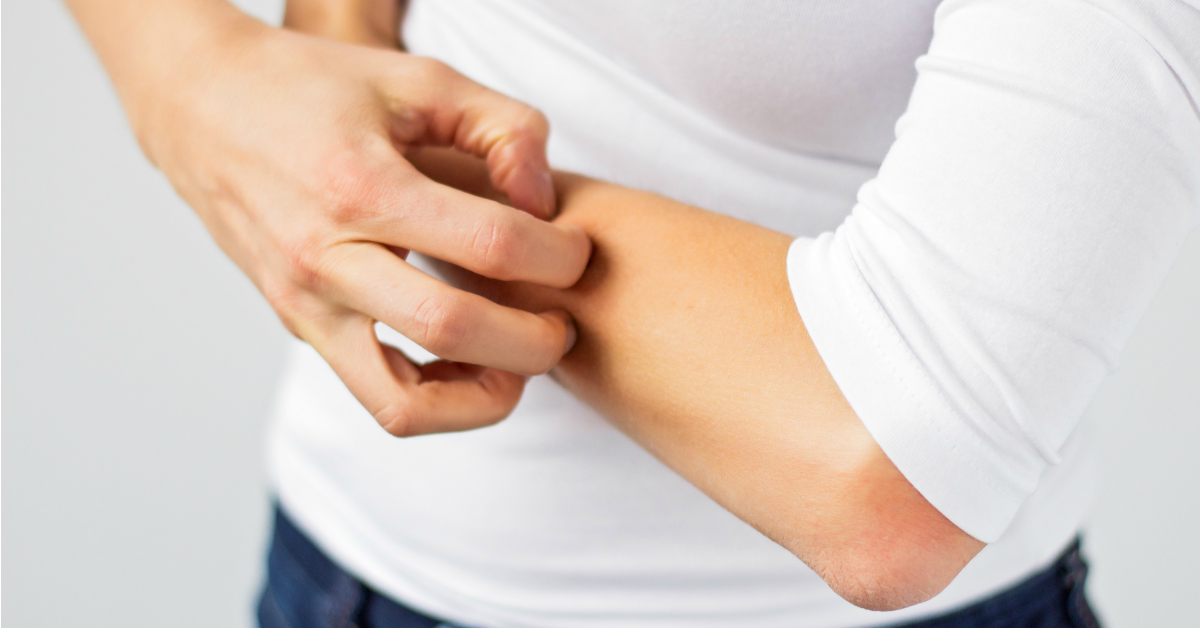 Dureri articulare după alergii, Artralgie vs artrită: care este diferența?