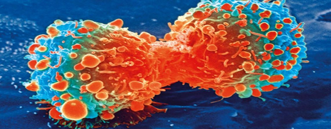 Articol Predispoziția genetică la cancer poate fi învinsă prin alimentație - Tehnologie pentru viață